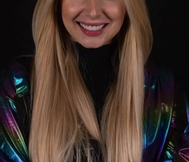 Facetas e Lentes — Rebeca, imagem 2