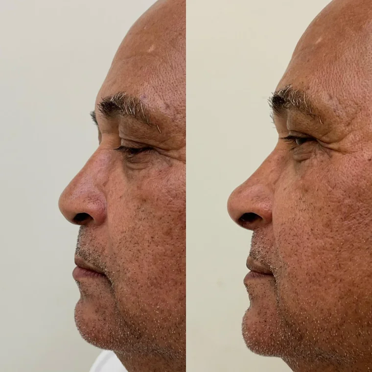 Contorno com naturalidade