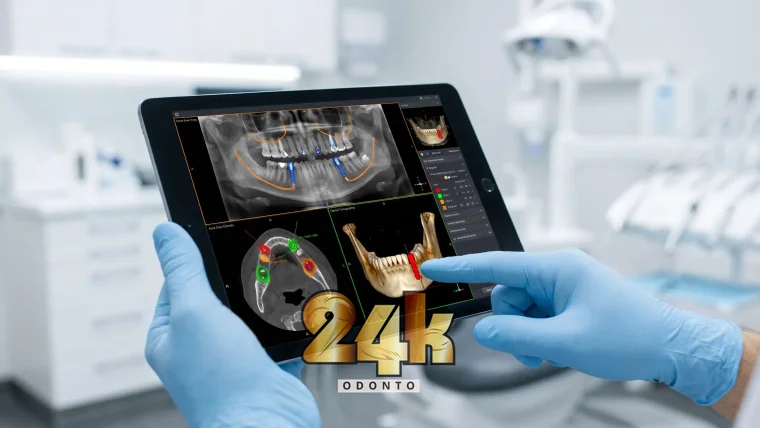 Protocolo na 24K Odonto