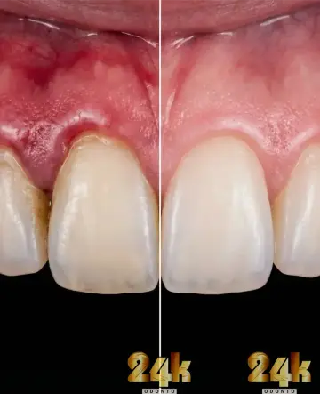 Periodontia